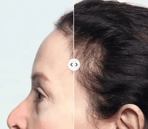 Rutina Capilar Intensiva Cash® - 4 productos